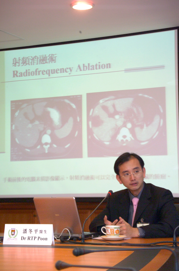 First radiofrequency ablation for cancers in Hong Kong